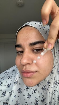 the most satisfying part of my morning ✨ft herocosmetics & theinkeylist 

#acne #pimplepatch #skinpositivity #realskin #pimples #breakout